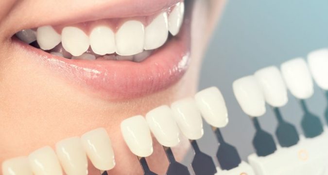 Sydney Cosmetic Dentist